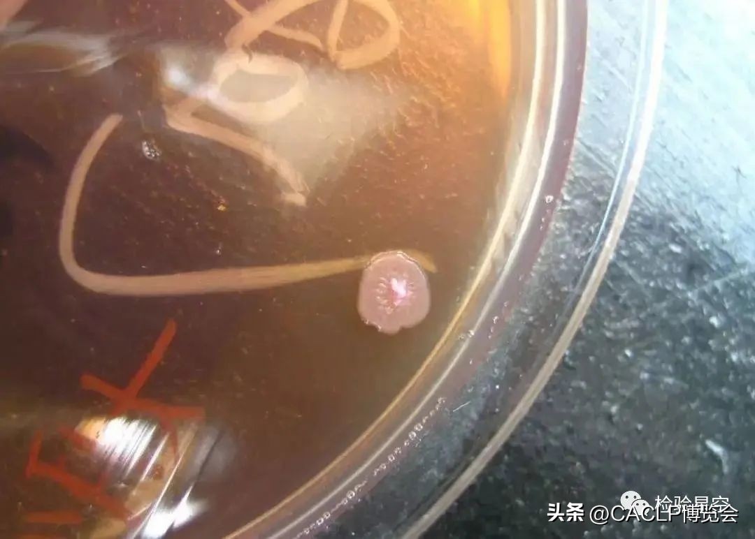 2017版医疗器械分类目录对照表,17年医疗器械分类目录21类