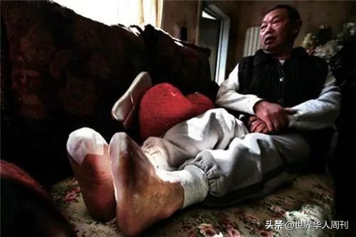 世界第一无腿登顶珠峰,无腿大爷登顶珠峰纪录