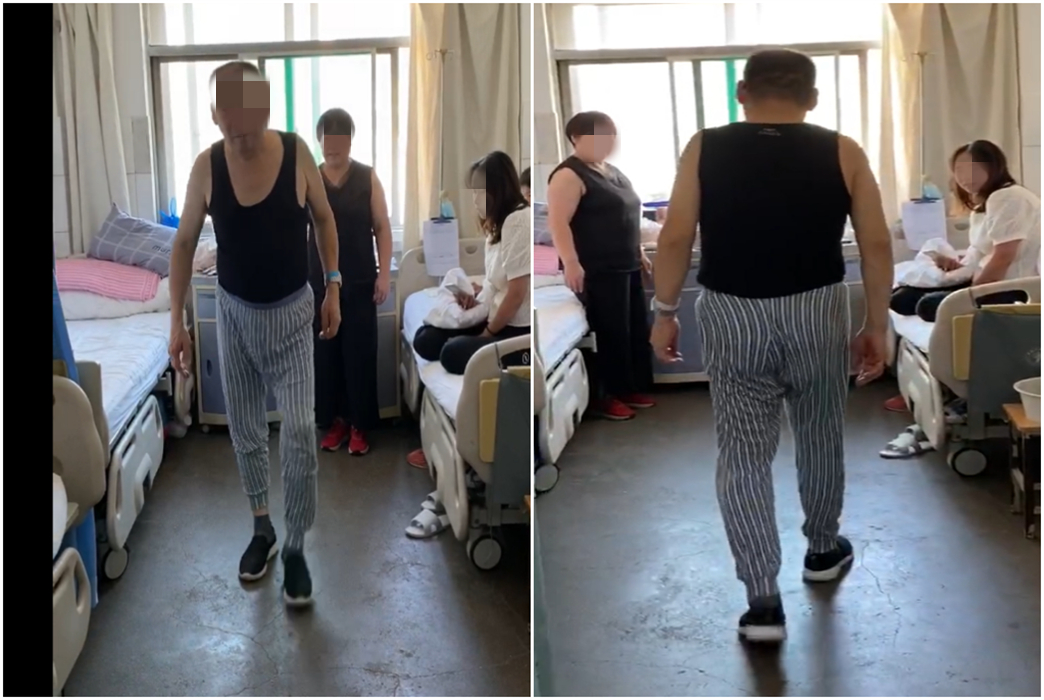 西安市红会医院风湿免疫内分泌科治疗一例免疫介导性周围神经病