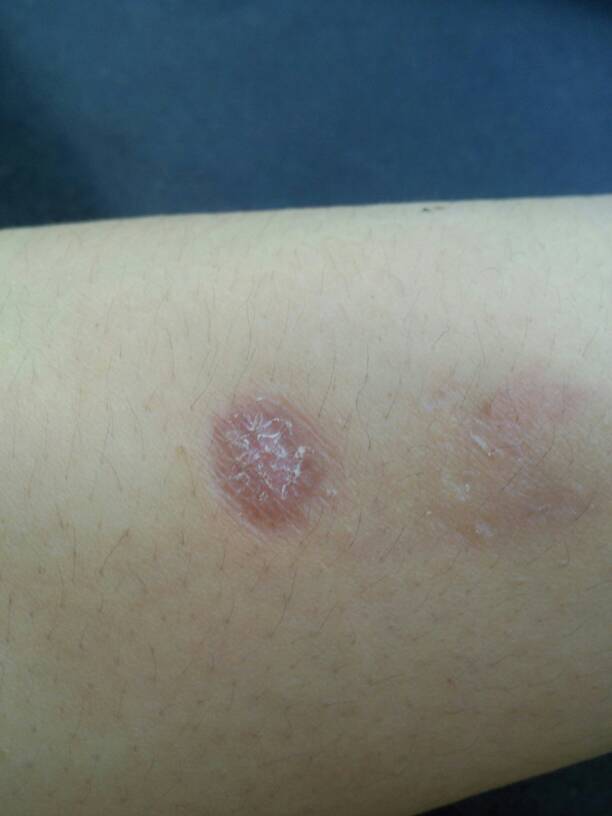 马登毅骗术截图,马登毅最后留下烟疤