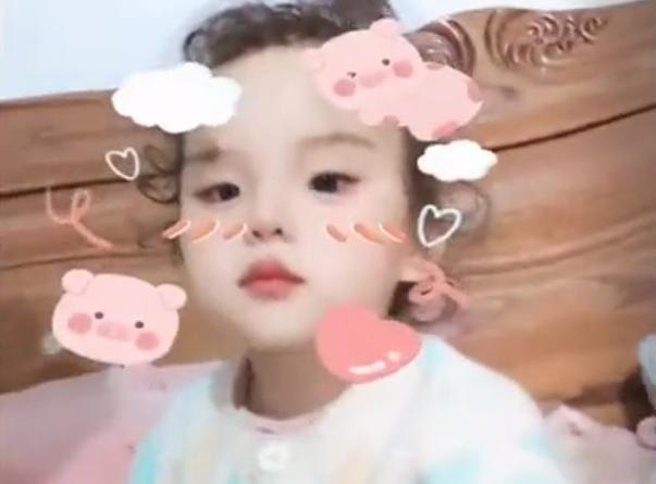 江苏一女儿吊水时乱动鼓针水肿，妈妈哭笑不得：成“注水猪蹄”了