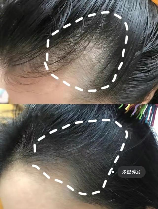 全网最好的防脱生发洗发水,洗发水推荐防脱生发改善毛躁