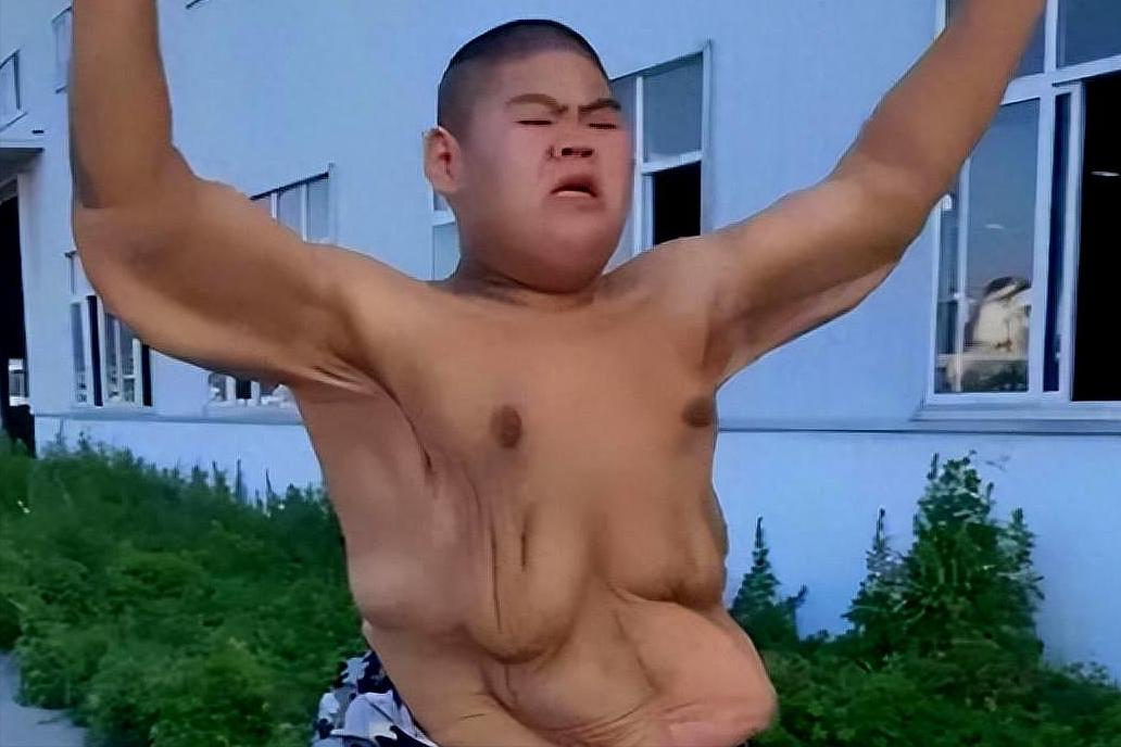 减肥400斤王浩楠照片,山东减肥小伙王浩楠现状