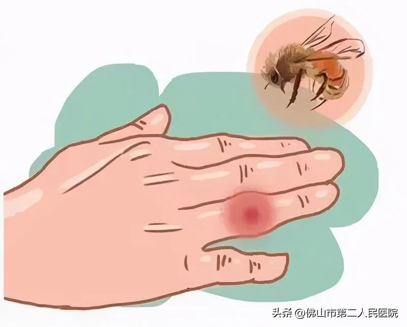 穿黄色衣服惹虫,春天穿黄色衣服招虫吗