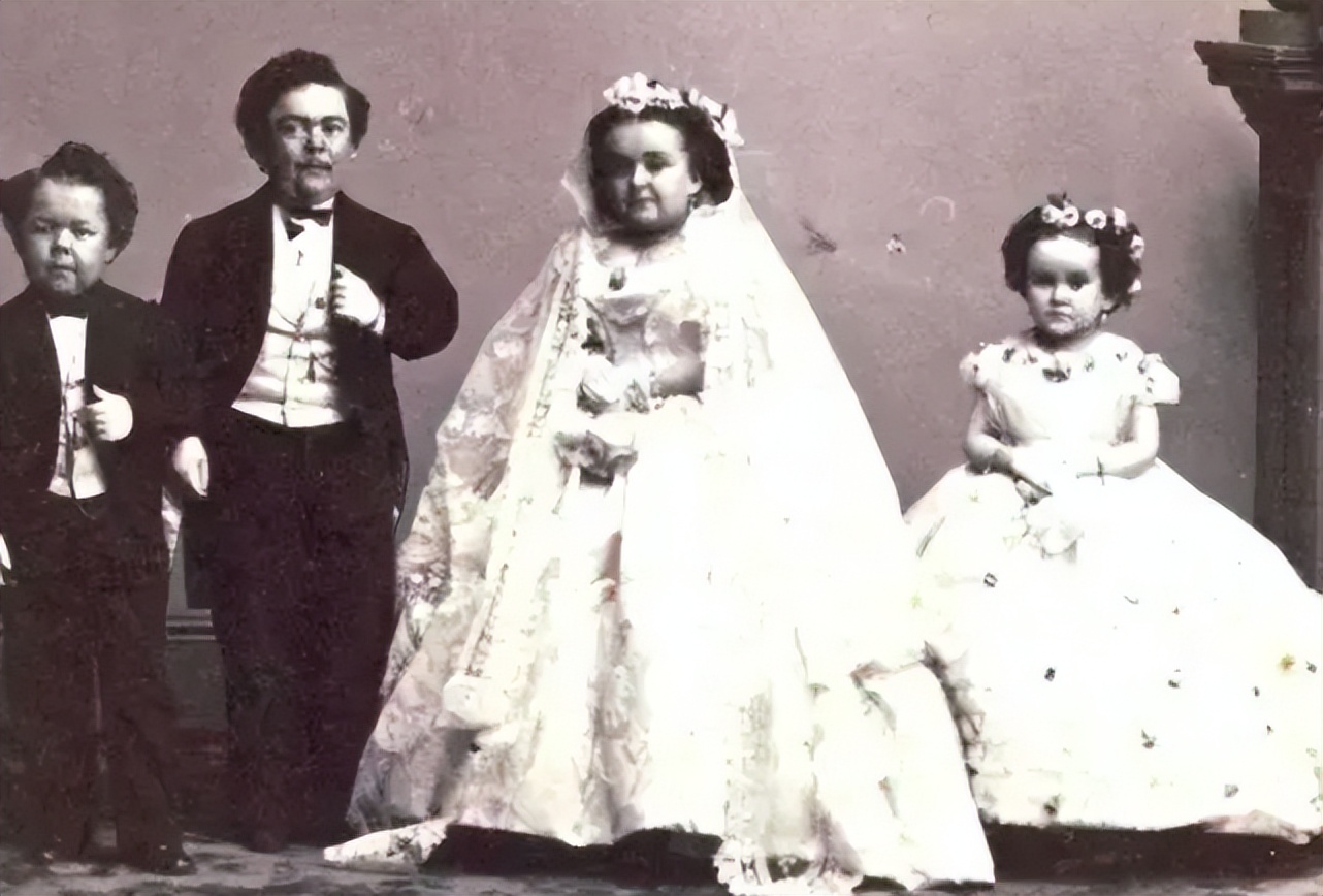 畸形秀背后的真相,畸形秀真实事件