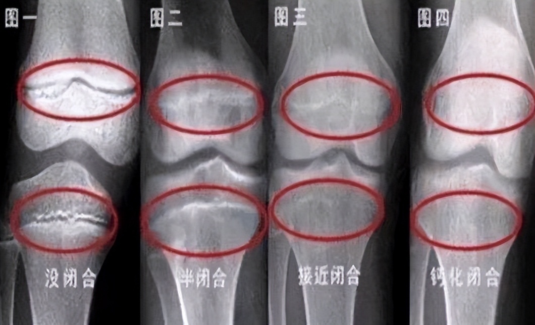 13岁女孩身高150还能长高吗,13岁半女孩身高163厘米还能长高么