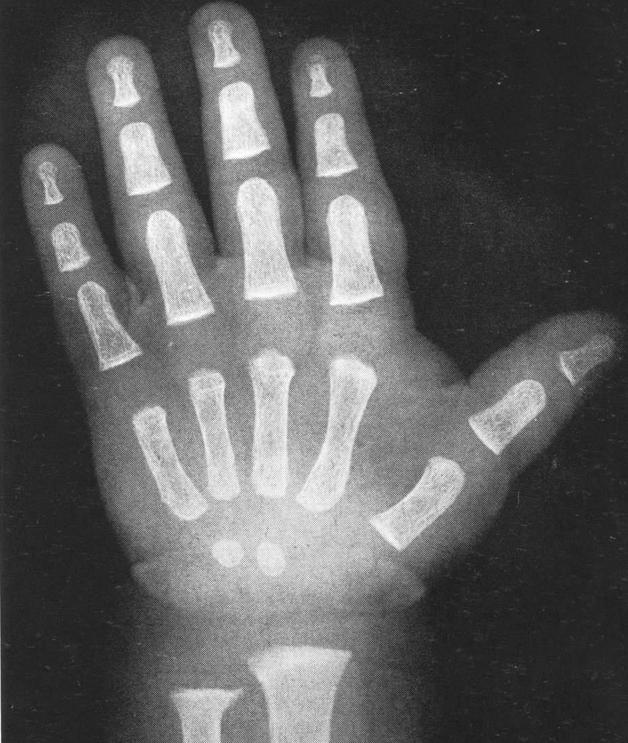 孩子长得又矮又慢？7个长高常识，家长要牢牢记住，帮孩子长更高