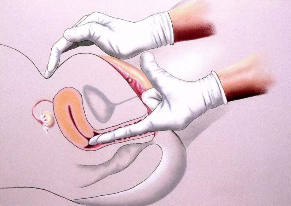 女生体检妇科有什么要注意的吗,体检为何未婚不推荐做妇科检查