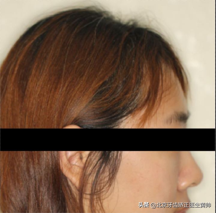 嘴凸的人怎么笑起来好看,嘴凸怎么让自己不焦虑