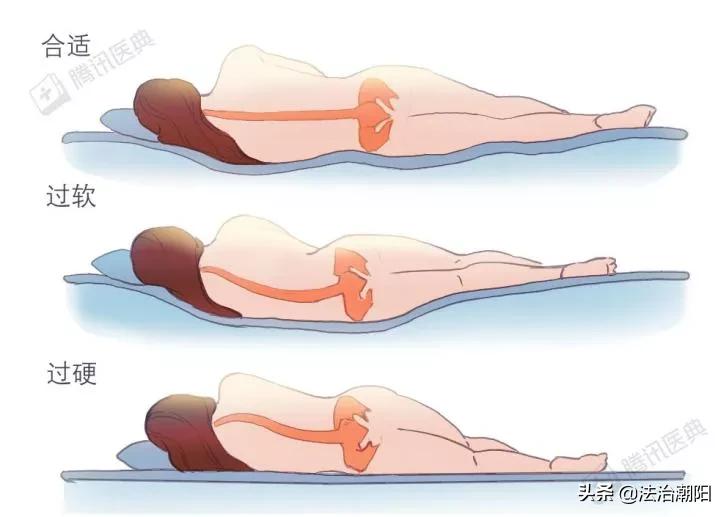 睡硬板床不能治腰椎间盘突出！3个小误会一次说清