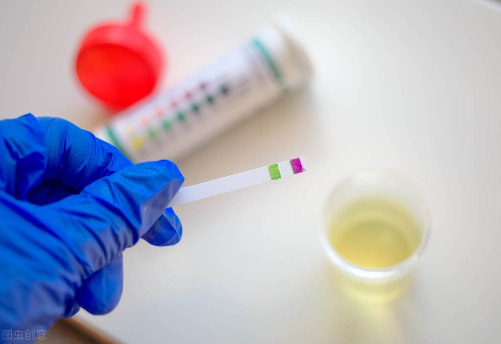 尿蛋白怎么控制才能消失,尿蛋白怎么控制不会复发