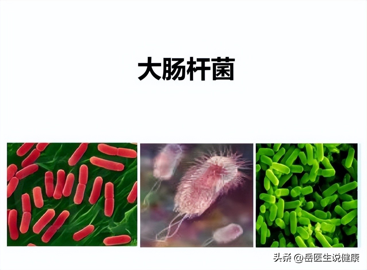 尿路感染了吃什么药,尿路感染要用什么药治疗好