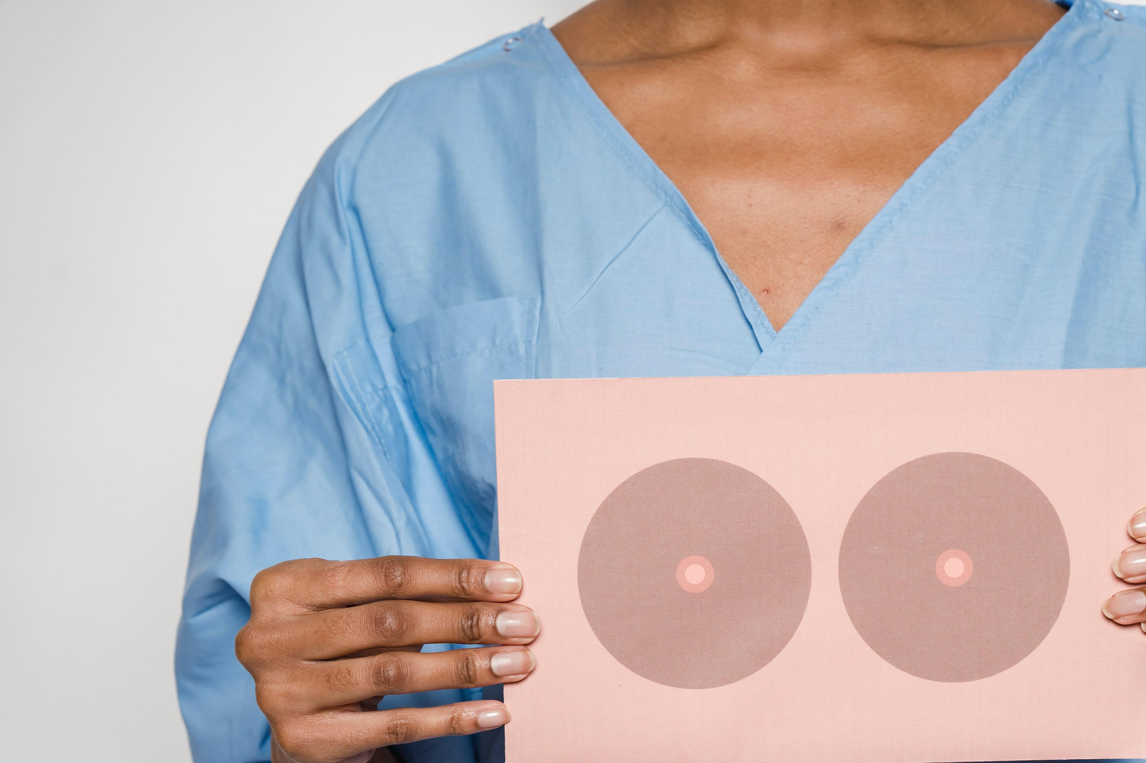 乳房重建材料大不同，乳腺癌患者该如何选择？