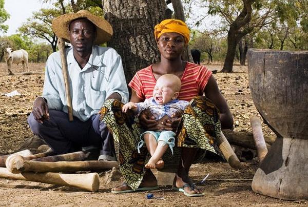 非洲版唐僧：血液堪比钻石，躯干价值126万元，警方24小时守卫