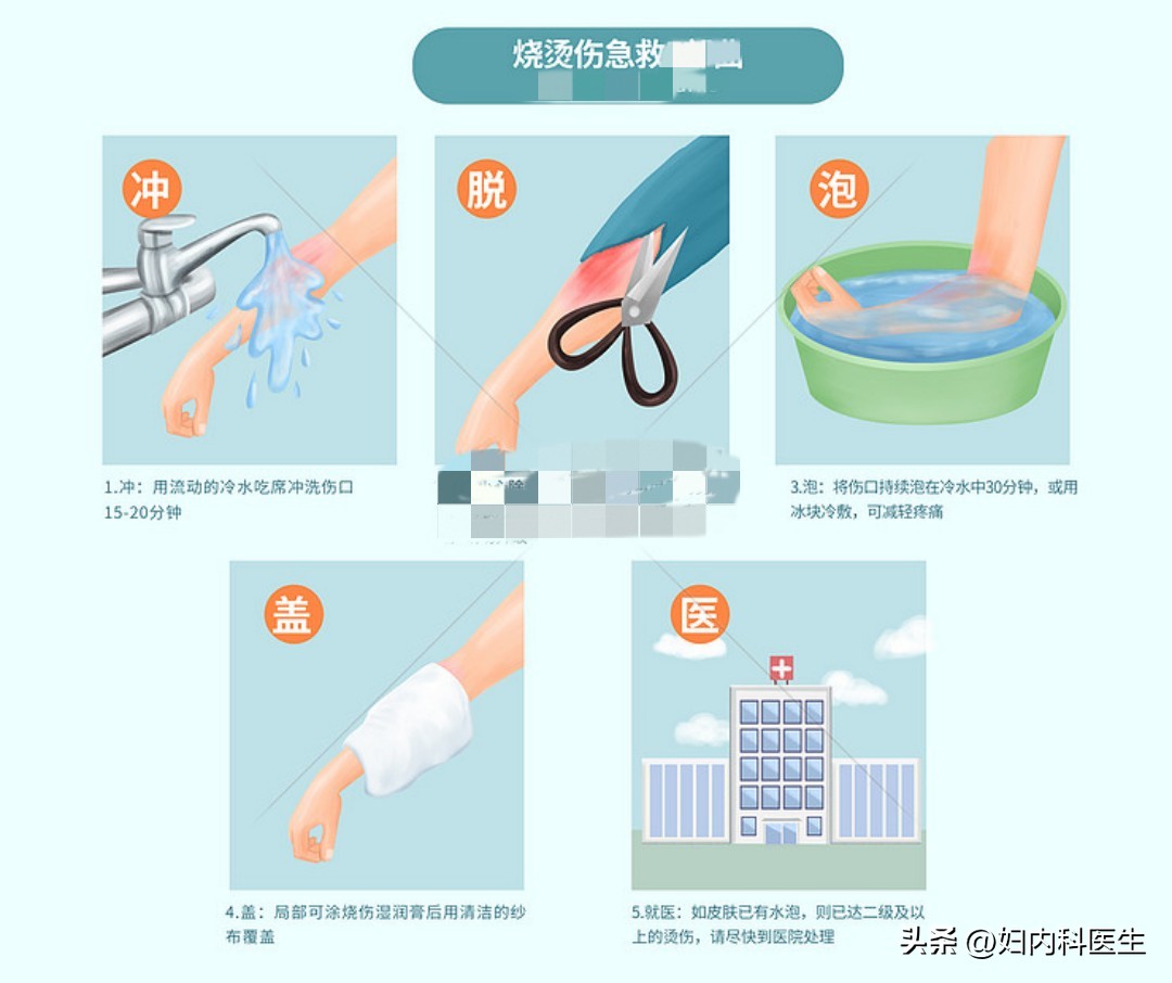烧烫伤后该怎样处理？医生一文告诉您