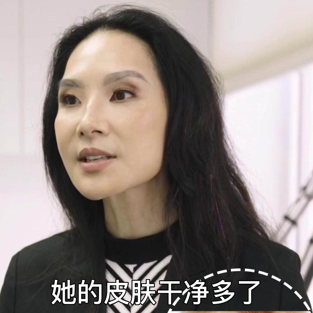 学生党黑头痘痘粉刺多怎么办,痘痘粉刺黑头说拜拜