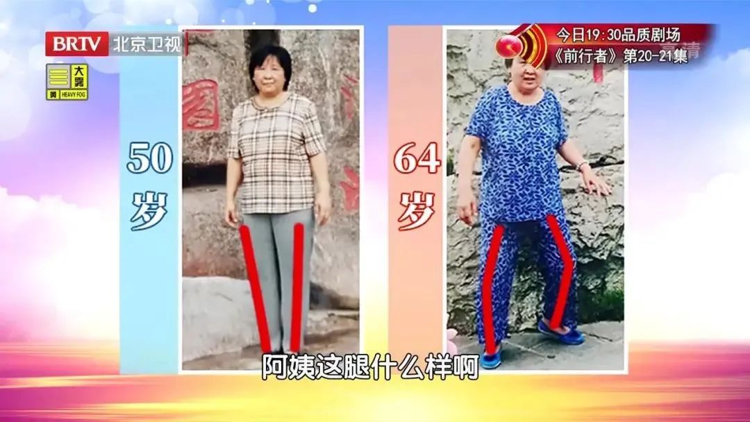 膝关节老化多大开始,膝关节问题发现越早越好