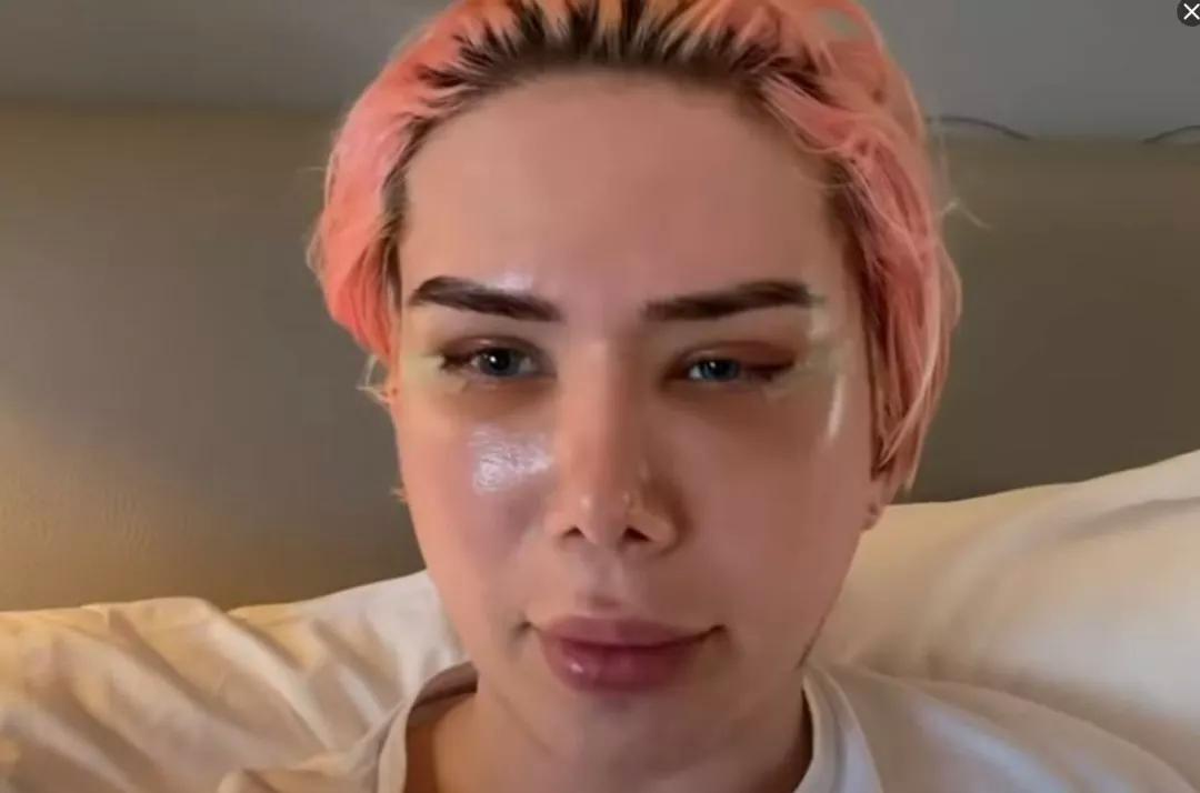 白人网红整容韩国人,白人网红整容18次