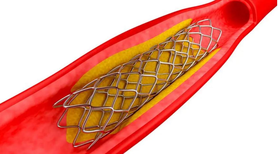 为什么吸烟能引起心梗呢,吸烟为什么会导致心梗