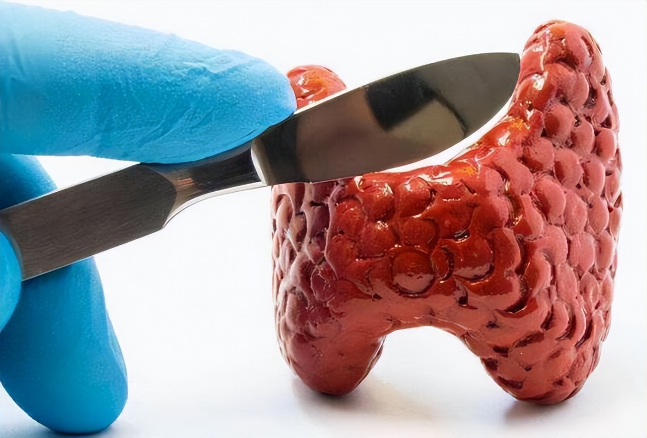 优甲乐效果虽然好，但也要时刻警惕这6个副作用，别不以为意