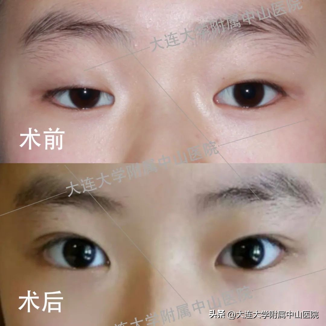 中山慈善万人行启动仪式,中山慈善现场直播