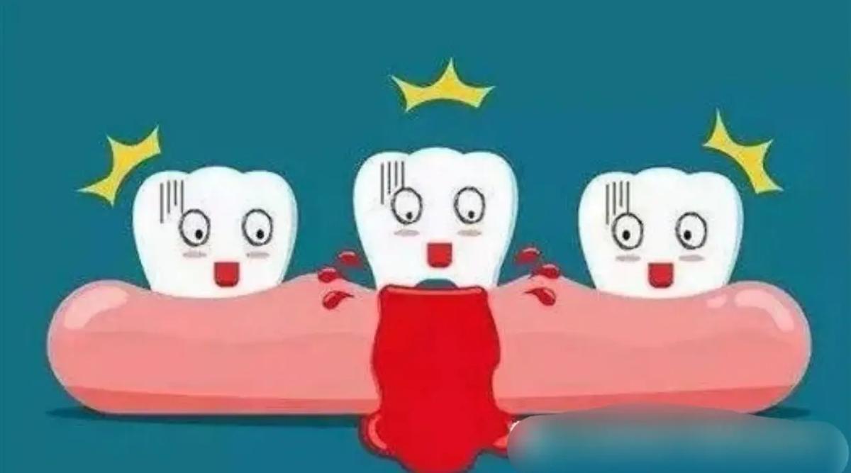 牙龈出血的吃饭的禁忌,牙龈出血容易出现哪些危害