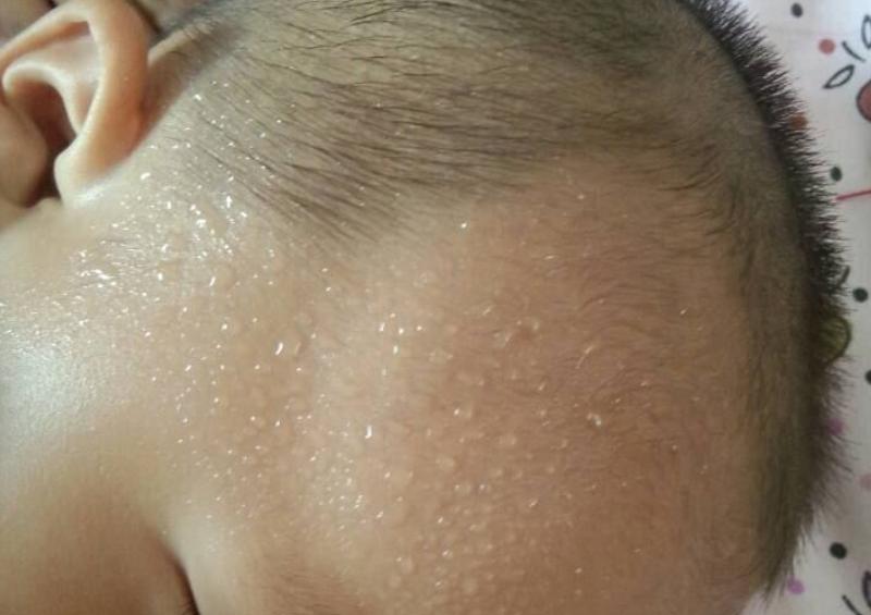 宝宝睡觉时大汗淋漓,宝宝睡着后满头大汗缺钙怎么补