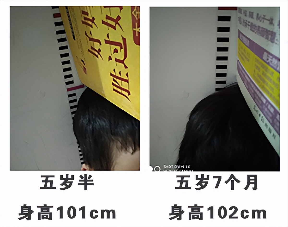 矮小症中医调理,中医调理矮小症医院