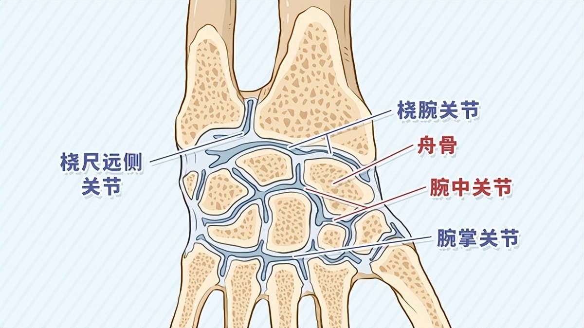 手腕哪里疼可以判定舟骨骨折,腕舟骨骨折手腕肿胀多久消失