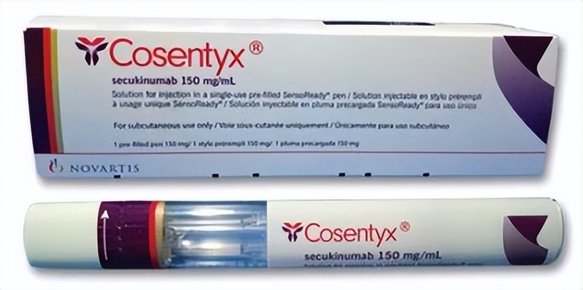 司库奇尤单抗能治关节炎吗,司库奇尤单抗对强直的功效与作用