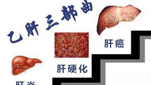 得了乙肝糖尿病不治了能活多久,得了乙肝会造成什么后果