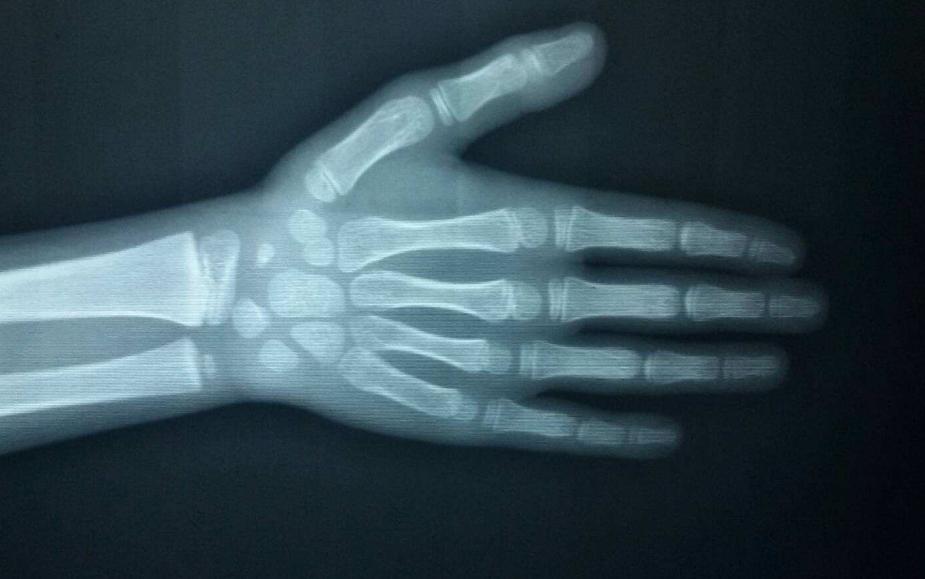 14岁身高170cm到18岁能长多高,身高能长到1米9吗