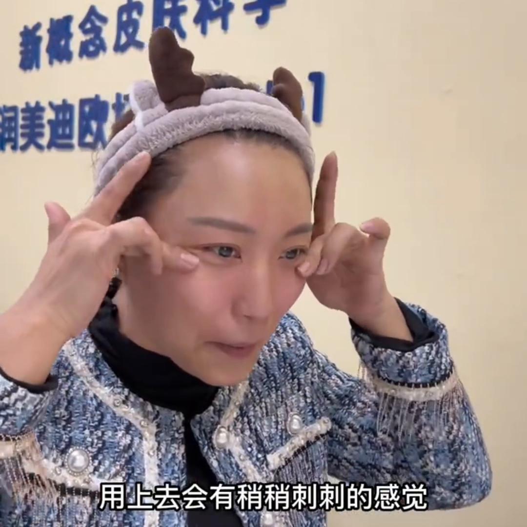 三颗润美迪欧钻石💎面膜，变化太大了#护肤分享