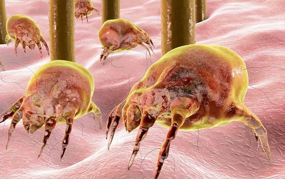 广州一女子坚持用硫磺皂水洗头,湖南校花坚持用硫磺皂洗头