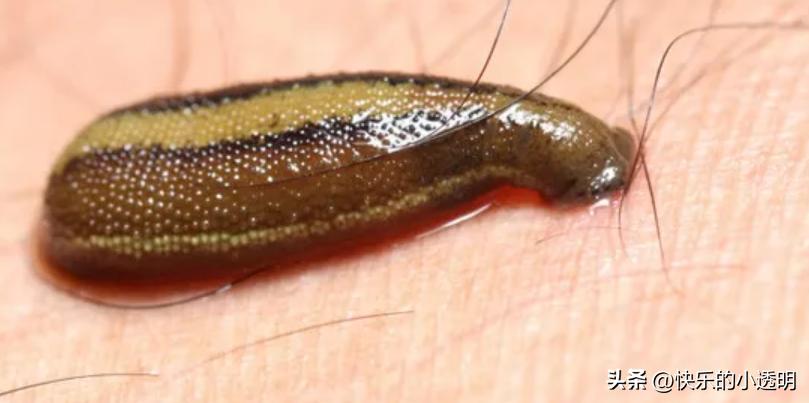 如果蚂蟥吃进肚子里能长期存活吗,蚂蟥食入体内能存活吗