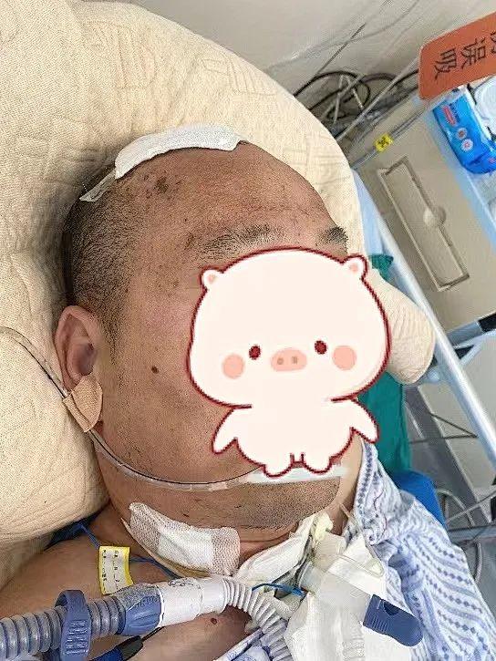 气管切开脱不了呼吸机怎么办,气管插管病人拔不了管怎么办