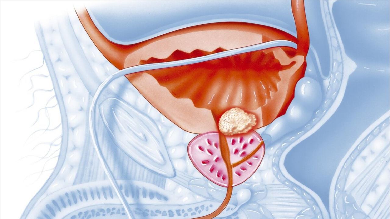腿变细是预示身体什么病,腿型对腿粗细的影响