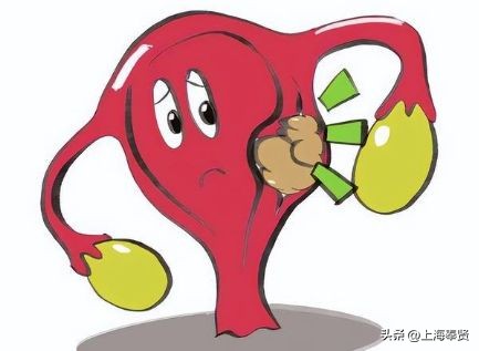 激素子宫肌瘤中医能根治吗,激素治疗肌瘤有效吗