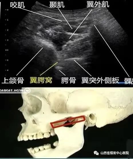 山西煤炭中心医院超声科主任,山西省煤炭中心医院在哪