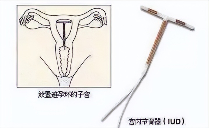 排卵期出血白带带血丝正常吗,经期10天后白带有少量出血