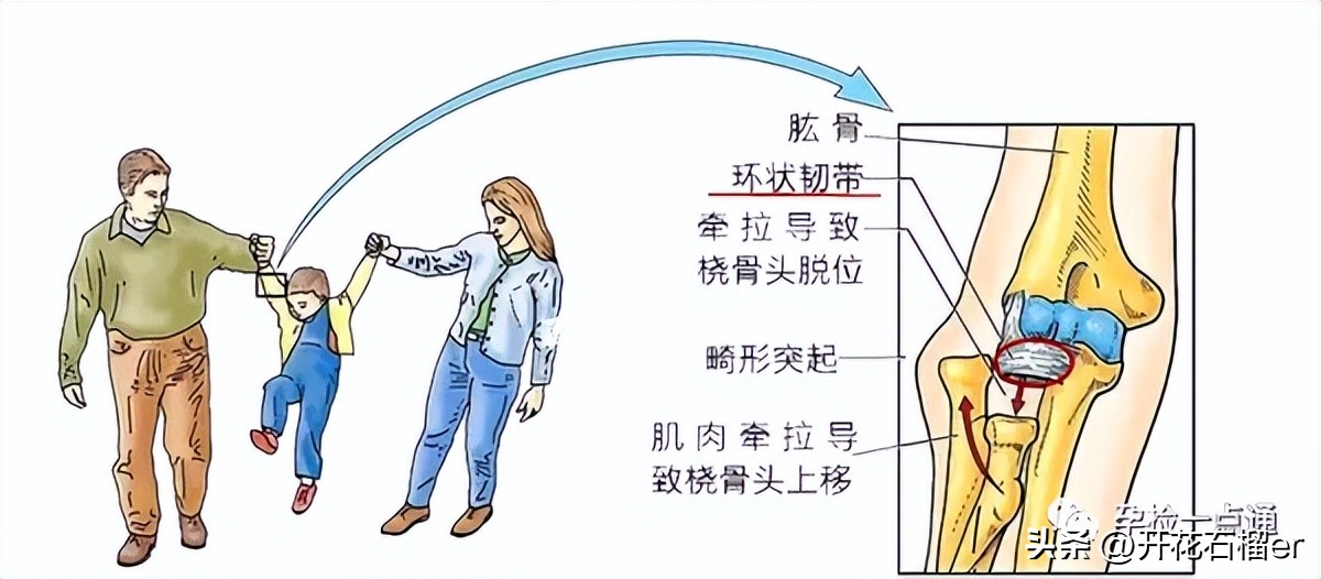 小月龄宝宝习惯把屎把尿如何纠正,8个月宝宝把屎把尿到底好不好