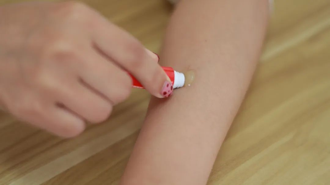 念珠菌阴道炎如何彻底治愈,怎么避免真菌性阴道炎反复发作