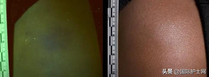 美国护士护理操作,美国护士发明28件实用神器