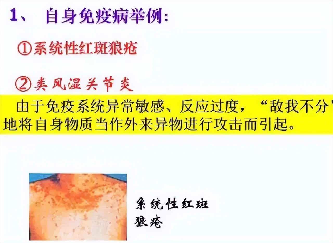 生物高中知识点免疫调节,高中生物免疫调节精讲视频