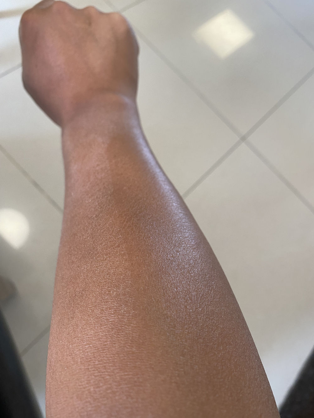 身上老是洗不干净是怎么回事,洗完澡皮肤干痒起白皮屑怎么回事