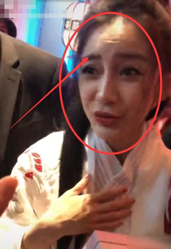 脸上有痘坑的明星,脸上爆痘特别多还好看的明星