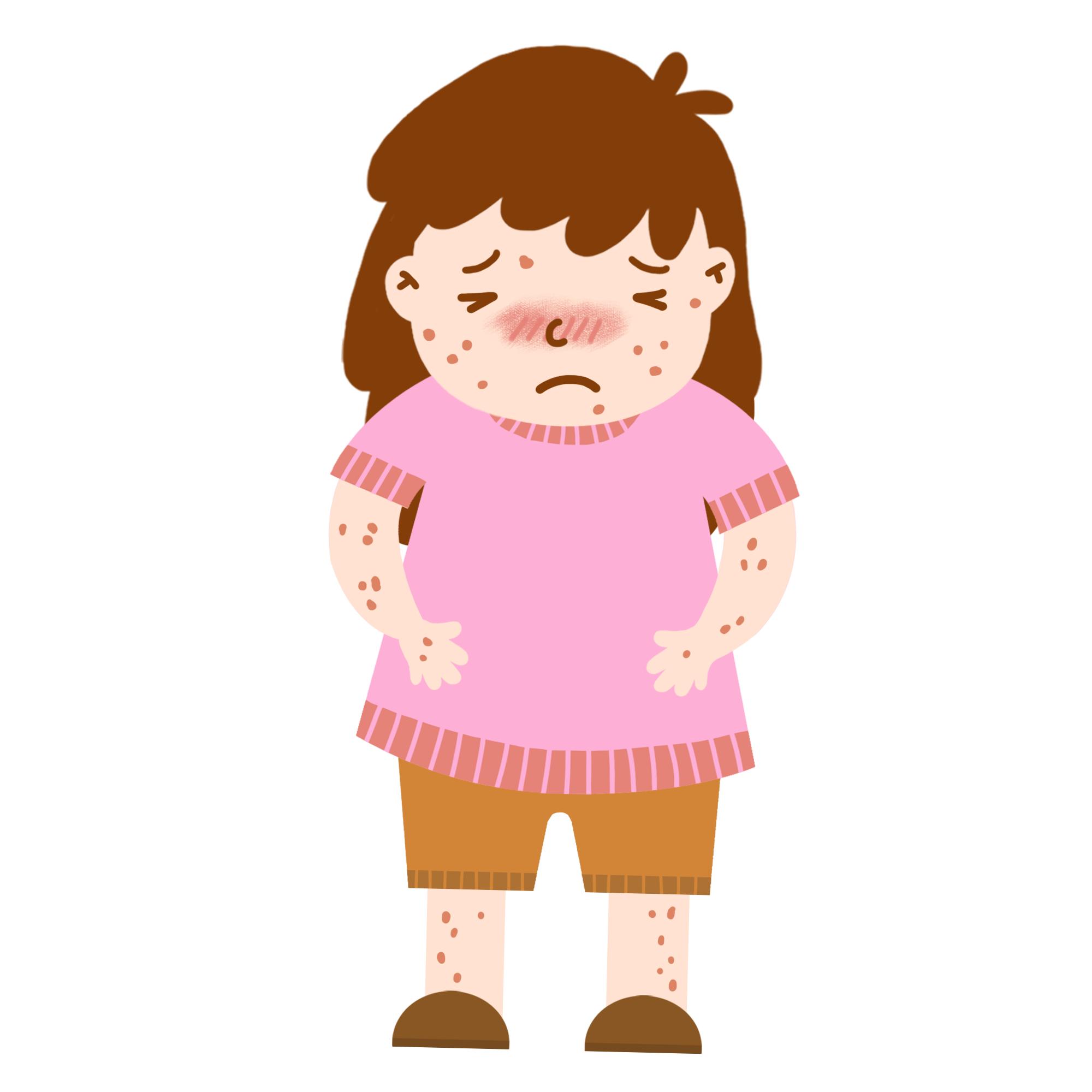 胎毒指的是什么,胎毒指的是黄疸吗