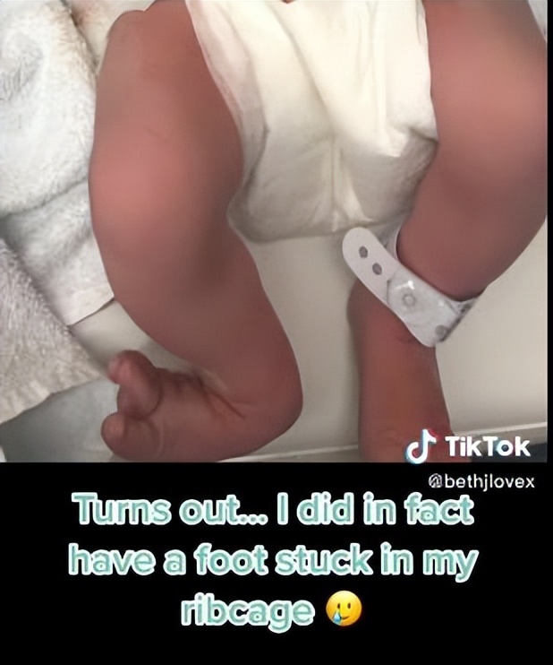 孕晚期胸口疼对胎宝宝有影响吗,孕晚期胎儿抵到肋骨疼