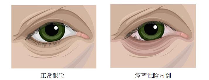 南石医院眼科位置,南石医院眼科怎么样