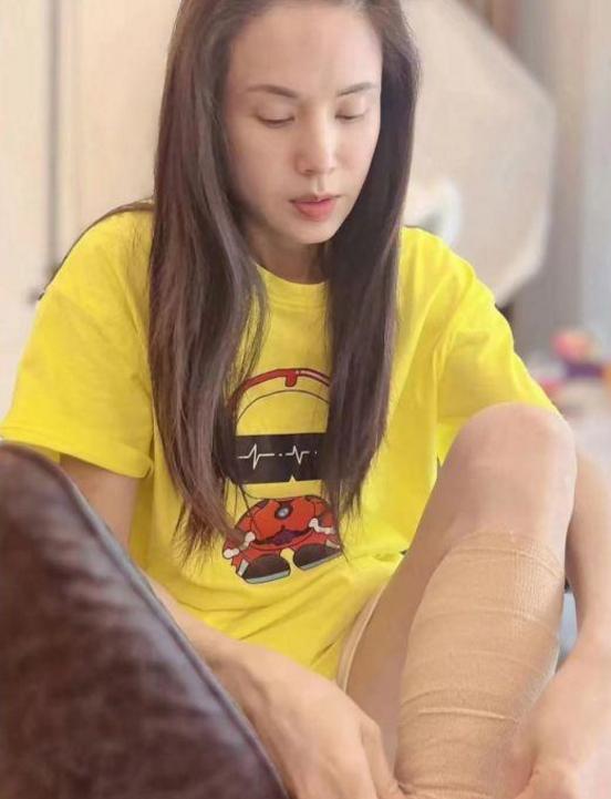 52岁李若彤肌肉图片,李若彤膝关节骨折过吗